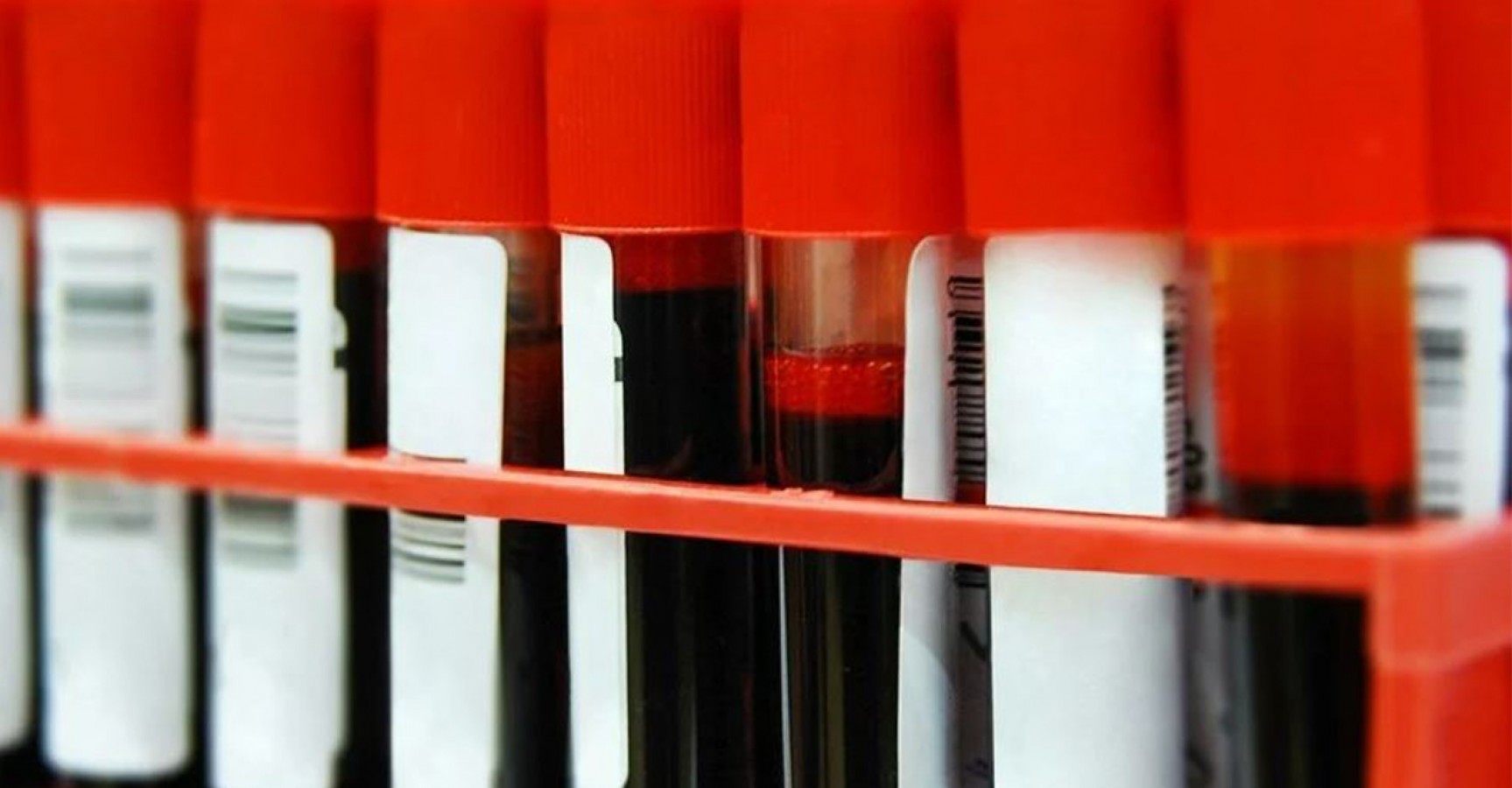 Kan grupları sağlığa dair ipuçları veriyor