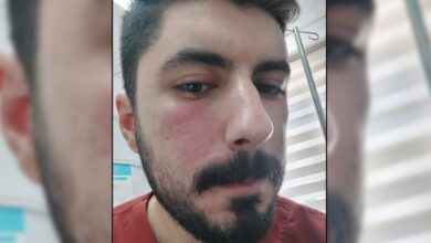 Urfa'da sağlık çalışanına şiddet!